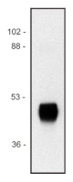 HRP | Horseradish peroxidase (mouse monoclonal) (clone HP-03) in the group Antibodies Plant/Algal / Environmental Stress / Plant Oxidative Stress at Agrisera AB (Antibodies for research) (AS21 4617)